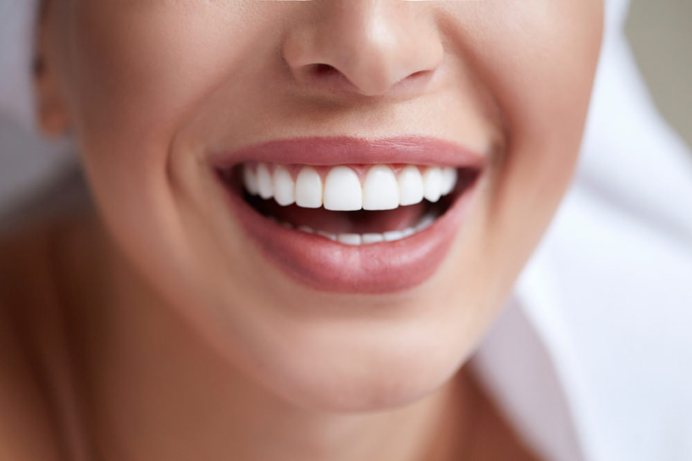 Unlock Your Brightest Smile in 2026: My In-Depth, No-Holds-Barred Review of HiSmile US Teeth Whitening Products